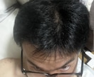 勃起EDの悩み誰にも言えないことを安心して話します 「勃たない」「途中で萎える」―人で抱え込んでいませんか？ イメージ1
