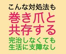 巻き爪でお困りの方へ、わたしの対処法を紹介します 以前は両足の親指が化膿していましたが今は好転しかなり歩けます イメージ3