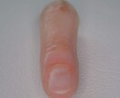 けがや事故で指を欠損した方の義指を製作出来ます 全国各地対応可能！フルオーダーメイド イメージ4