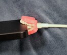 歯科医院での初めての補綴コンサルを教えます 補綴カウンセリング実践ロープレ集〜売り込まず信頼を得る会話術 イメージ3
