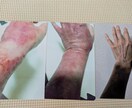 くり返す肌荒れ経験者がその苦しさ受けとめます ずっとくり返す、なんで私だけ? もうイヤ!! イメージ4