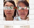 50歳を過ぎてからでもお顔が若返る顔ヨガ教えます 効果がすごいとお声が多数。高級化粧水やエステの効果もあがる！ イメージ9