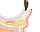医療専門イラスト◆現役の医療従事者が描きます 学会、論文、資料、書籍などにご使用いただるシンプルなイラスト イメージ3