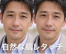 自然な肌レタッチ・ニキビや肌荒れを修正ます 満足いただけるまで無料で対応いたします イメージ3
