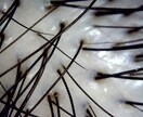 遺伝・更年期は思い込みかも？薄毛の原因話します 薄毛・脱毛に悩むあなたへ。私の話しを聞いてください。 イメージ2