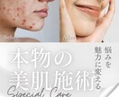 インスタ運用代行します 丸投げOK 実績多数！ 毎日投稿も！現役SNSチームが対応！ イメージ5