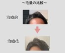 薄毛に悩む方に！薄毛対策教えます 〜思ってたよりも安く薄毛対策出来ます〜 イメージ3