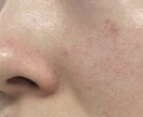 顔写真の肌荒れや肌色を直します あなた用のお好きな肌加工をします イメージ1