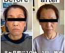 治らない悩み…歯科難民を根本から救います 機能だけでなく整形級の美しさ、小顔を求める方にもアドバイス！ イメージ2