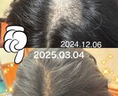 抜毛症専門！あなたの苦しみに寄り添います 私の経験談を詳しくお話します。 イメージ1