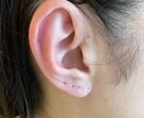 耳ツボ　体の不調な部分のツボお教えします 耳ツボセラピストです♪不調を改善しましょう。 イメージ2