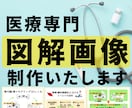 医療の専門性を優しく伝える図解画像を制作します 患者さんにも伝わりやすい安心感ある図解画像を制作いたします。 イメージ1