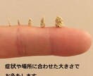 意外と知られていないお灸の使い方教えます 小さなお子様から大人まで日々が快適に過ごせるお灸の使い方 イメージ1