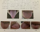 心身が発する警告を漢方薬剤師が舌相占い?を致します あなたに必要な食べ物や過ごし方をあなたに寄り添い案内します。 イメージ2