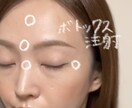 美容整形の疑問にお応えします 色んなクリニックに通ってきたので情報豊富だよ イメージ3