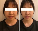オンラインで体験★「小顔矯正」施術します 自分の手が美顔器以上に！#小顔＃美肌＃骨格＃顔ダイエット イメージ2