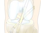 整形外科専門医が医療イラストを描きます 論文用シェーマや患者説明用イラストなどに！ イメージ4