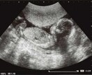 赤ちゃんの性別♡エコー画像で性別診断致します 12週からのエコー画像または動画で性別判断を致します！ イメージ3