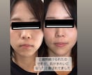 顔ヨガで小顔、リフトアップになる方法を教えます 疲れ顔、老け顔に効果あり。表情筋鍛え方学んでみませんか。 イメージ7