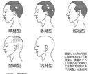 脱毛症で悩んでる方、病気で悩んでる方の相談のります 悩んでる方同じ境遇である僕と話して少しでも楽になりませんか？ イメージ3