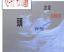 専門医が赤ちゃんの性別予測とエコーの解説をします ベビーナブ対応！11週以降のエコーであれば判定します。 イメージ2