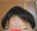 薄毛を克服した体験談を提供致します 薄毛は改善できます！私はハゲの悩みから解放されました！ イメージ3