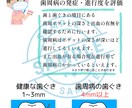 歯科で使える患者様への説明資料作成してます 患者様に説明する資料があればなと実際に感じたので作っりました イメージ3