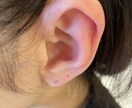 耳ツボ　体の不調な部分のツボお教えします 耳ツボセラピストです♪不調を改善しましょう。 イメージ1