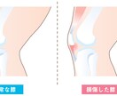 分かりやすい！伝わる！図解・解説イラスト制作します 整形外科・歯科・美容外科様など様々な図解イラストを作成 イメージ10