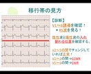 心電図の基礎を伝授します 心電図の基礎的な知識をまとめた資料を配布します！ イメージ1
