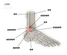 足首の捻挫を頻繁に繰り返す強化プログラム作成します 何度も繰り返し捻挫する問題には必ず原因があり〇〇を強化する事 イメージ8