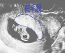 エコーにて最速妊娠6週からの性別予測をします 産婦人科、超音波専門医がラムジーメソッドにて性別予測！ イメージ2