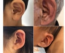 自律神経を整えスッキリ！耳つぼ健康法をお伝えします 施術人数述べ2,000人の経験から心やお身体のお悩みを解決 イメージ1