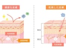 分かりやすい！伝わる！図解・解説イラスト制作します 整形外科・歯科・美容外科様など様々な図解イラストを作成 イメージ6