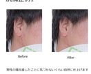 期間限定キャンペーンデータウェルカムボード作ります 肌にお悩みの方、見違えるような写真に仕上げます イメージ7