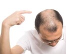 メンズヘアカウンセラー  薄毛のお悩み解消します ☆スタート価格500円☆AGA治療、植毛、育毛、ウィッグ イメージ1