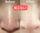 チャットで肌改善 個別相談（最大3日間）ができます 肌は十人十色！目指すはノーファンデ！ イメージ2