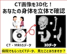CT画像を3D化！あなたの身体を立体で確認できます 病院でもらったCTデータ、見たことありますか？ イメージ1