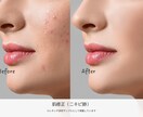 人物写真のレタッチ【修正・加工】いたします プロがナチュラルできれいに修正いたします！ イメージ2