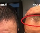 Amazon書籍で販売中の薄毛解消ノウハウあります 皮膚科と医薬品やサプリの輸入経験に基づく髪の毛の砂漠化改善法 イメージ2