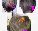 薄毛の悩み、相談にのります 諦めないで！誰でもできる薄毛予防対策 イメージ1
