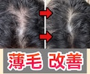 男性限定⚠️薄毛を改善させる方法をご提供いたします メンズの薄毛を徹底改善✨9割の増毛効果の実績✅ イメージ1