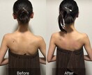 肩甲骨整体師が肩こりの原因を一緒に整理します 肩こりの原因、肩甲骨のプロが教えます イメージ4
