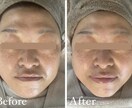 小顔コルギのセルフケア教えます 現役エステティシャンが教える圧倒的小顔セルフケアを教えます！ イメージ2