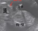 周産期、超音波専門医がエコーの確認、解説をします これはなにを見ているのかなど、胎児エコーを詳しく解説。 イメージ4