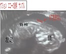 専門医が赤ちゃんの性別予測とエコーの解説をします ベビーナブ対応！11週以降のエコーであれば判定します。 イメージ9