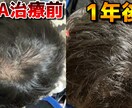 AGA治療歴3年！薄毛の悩みを解決致します プロの薄毛治療ライターである私が、あなたに最適な方法をご提案 イメージ1