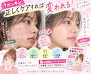 皮膚科ナースがニキビ、肌荒れのご相談のります 繰り返すニキビ一緒に原因を整理しませんか。特典付き♡ イメージ3