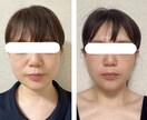 若返りケア教えます 美容医療に頼らないたるみ改善ケア イメージ3