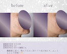 元美容看護師が企画込み美容クリニック投稿作ります “伝わる”企画込み投稿デザイン │ 美容クリニック向け イメージ8